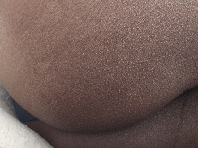 Chantalxxx - Gallery picture 1